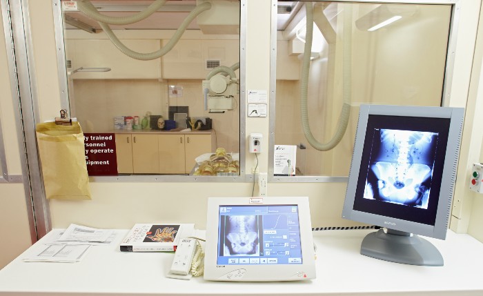 Computer screen with an X-ray image and a hospital bed in the background