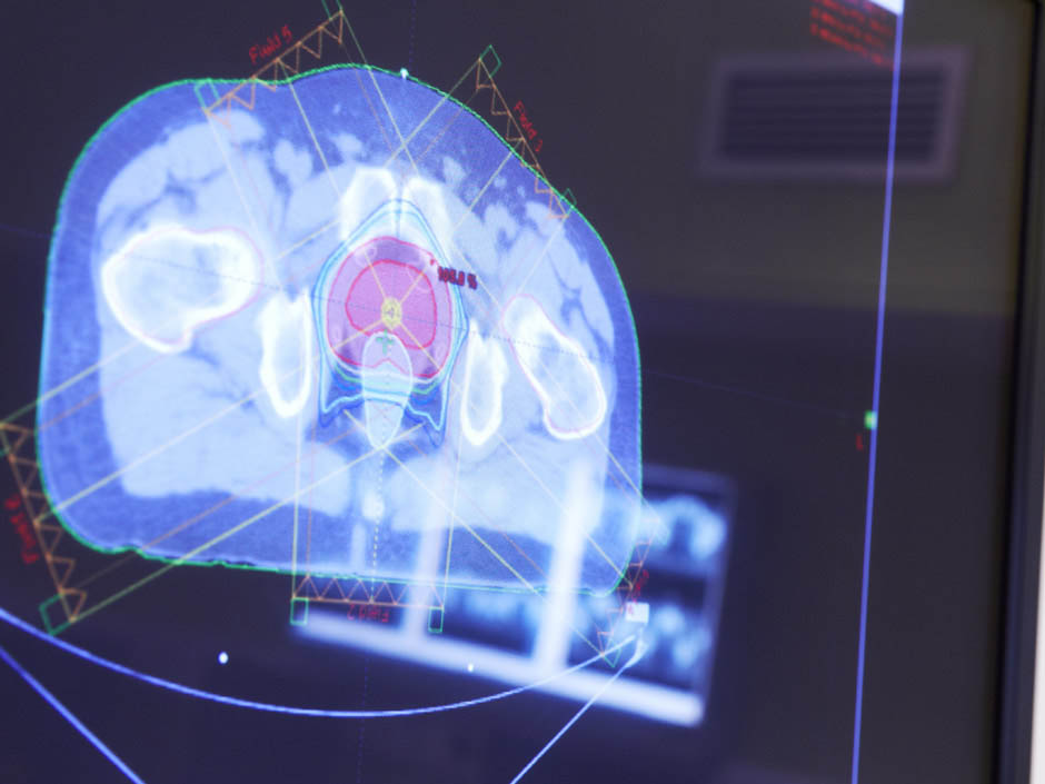 Screen showing brain scan