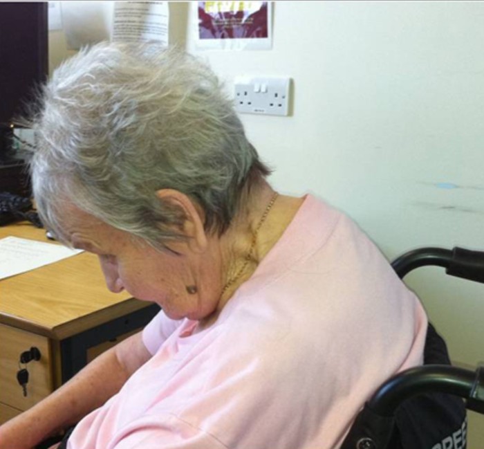 An older woman suffering neck weakness