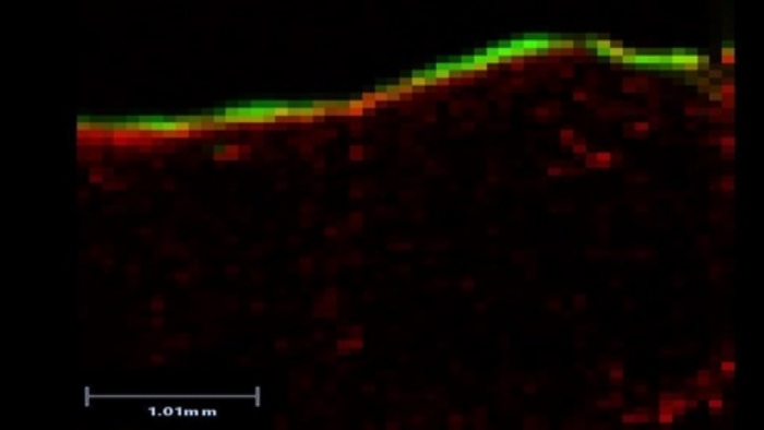 An Desorption Electrospray Mass Spectrometry Image of the distribution of the topical anti-fungal treatment terbinafine in a section of the living skin model Labskin showing that the drug is located in the upper layer of the skin model.
