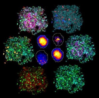 Cancer Research Group