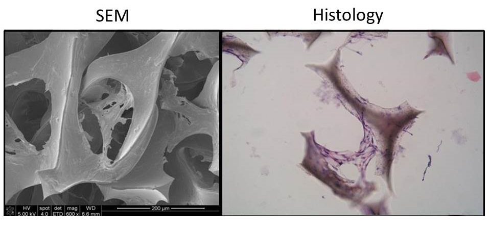 Cells and extracellular matrix forming bridges within auxetic foam scaffold pores