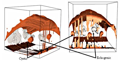 Different views of the 3D visualization produced using VTK for longitudinal plane.