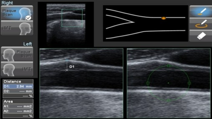 Specialist software and ultrasound imaging from the Cardiovascular research